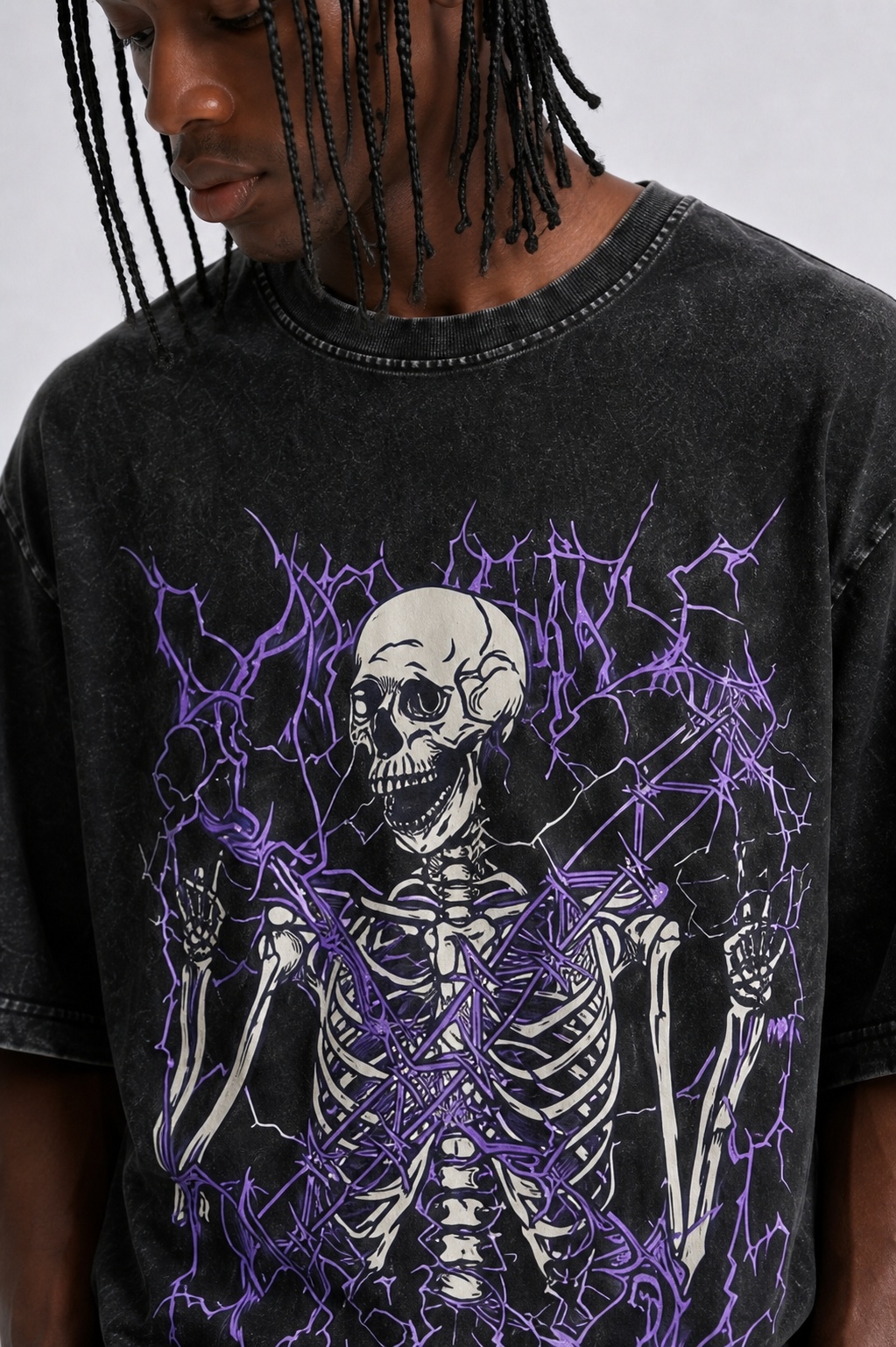 Oversized Electric Skeleton